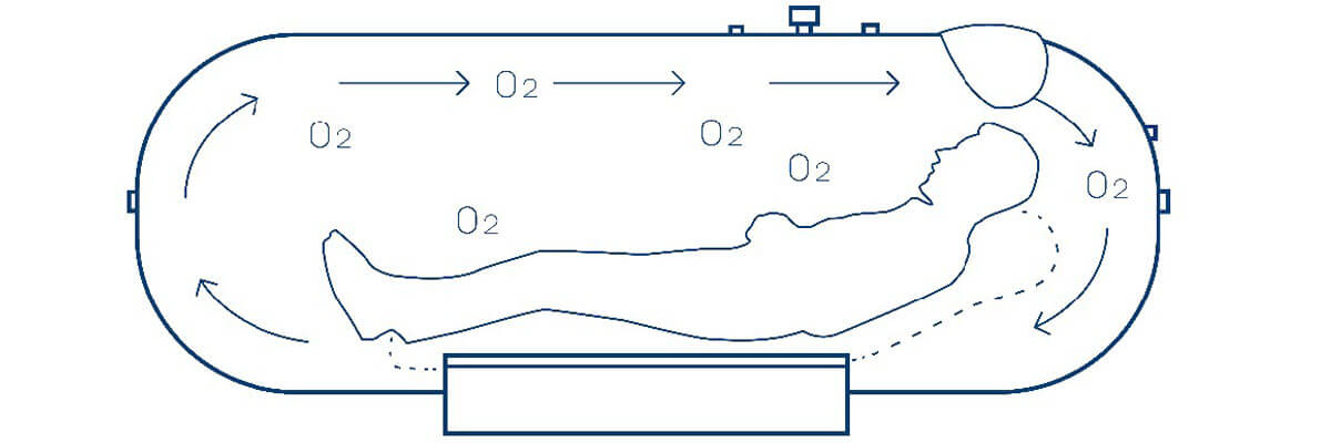 st901-portable-hyperbaric-oxygen-chambers-anti-virus-detail-01