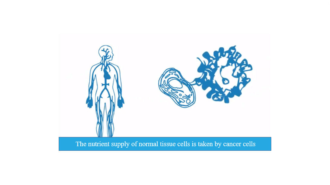 Cancer and Oxygen-18