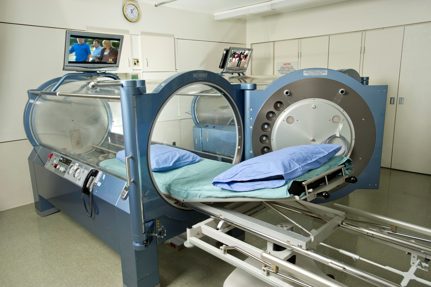 Hyperbaric chamber for sale: Everything you need to know about oxygen chambers