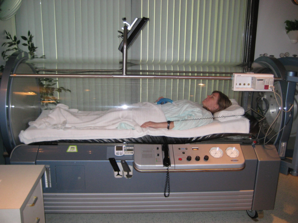 Hyperbaric o2 chamber 2021